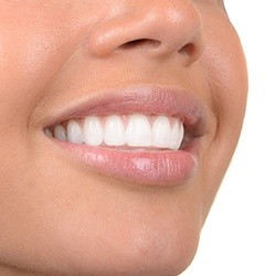 Closeup of brilliant white smile