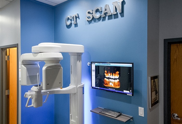 3D CT Scanner