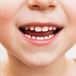 Closeup of child's healthy smile