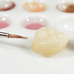 Custom dental crown prior to placement