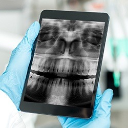 Digital x-rays on tablet computer