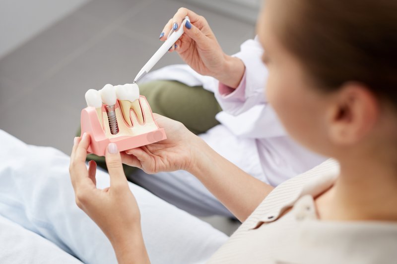 Patient holding model of dental implants